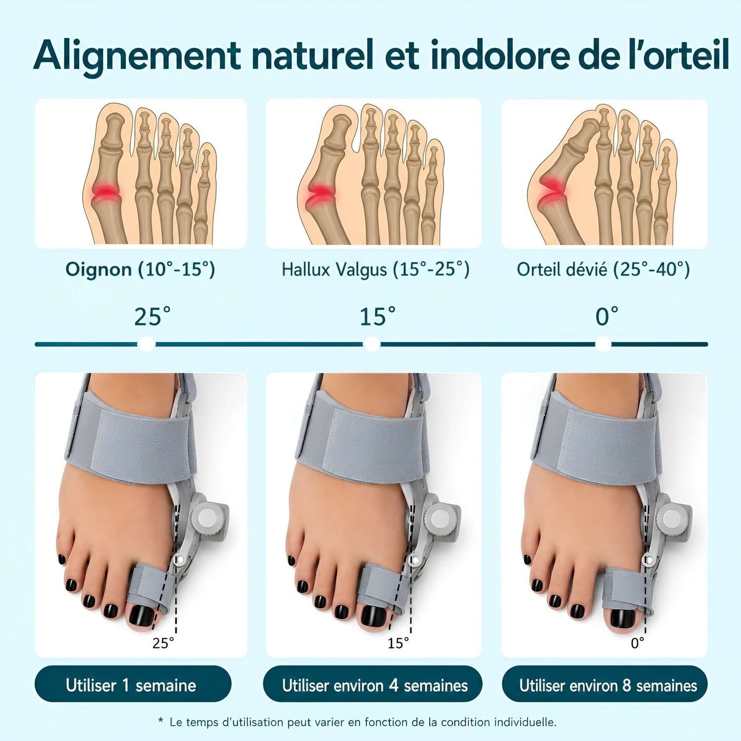 Attelle d&