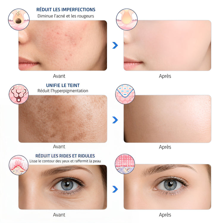 Masque de Luminothérapie LED — Soin Visage Anti - Âge & Régénérant - Aurélia CARE